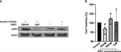 The liver-derived exosomes stimulate insulin gene expression in pancreatic beta cells under condition of insulin resistance